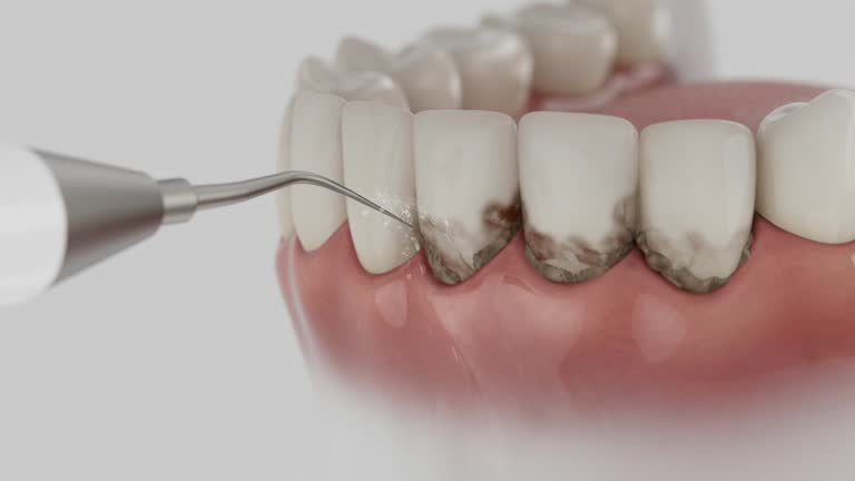 Reliable Dental contractor in Becker, MN by Dentist Open Now